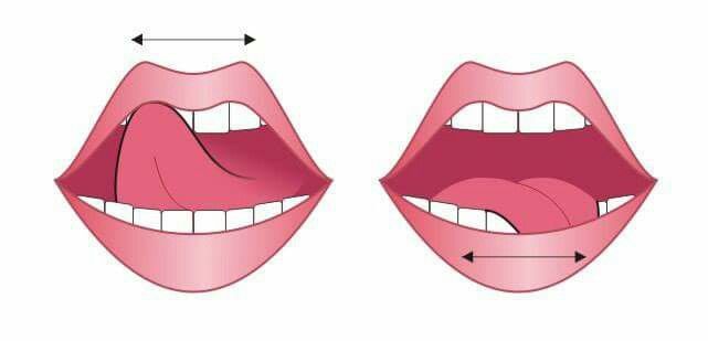 Артикуляция при брекетах